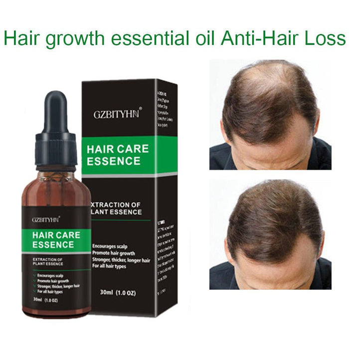 Hair & Scalp Oil — 30 ml - A.L.M