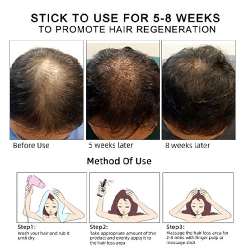 Hair & Scalp Oil — 30 ml - A.L.M