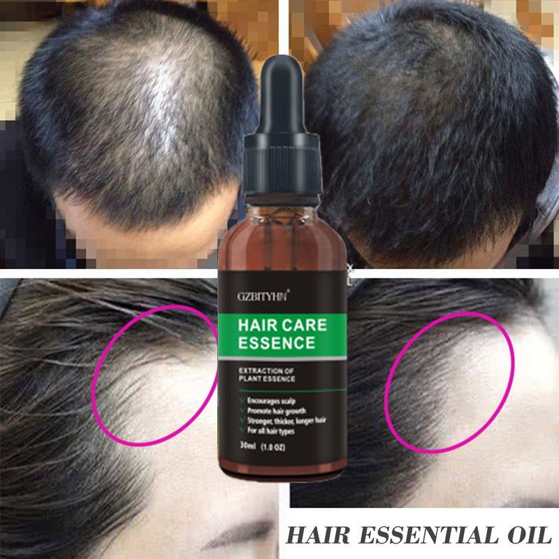 Hair & Scalp Oil — 30 ml - A.L.M